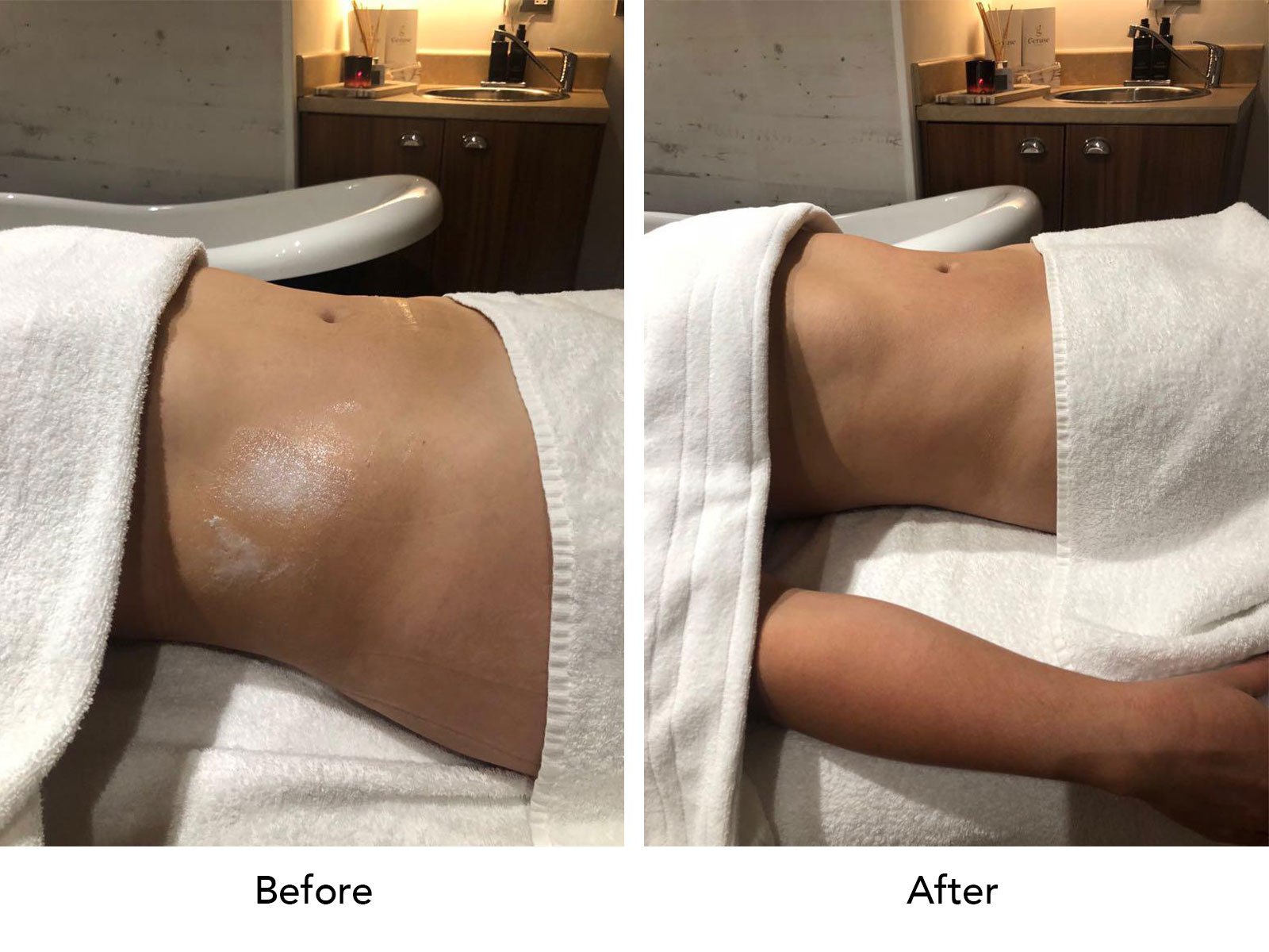 Lymphatic Drainage Massage - Curvydollbynancie | Lymphatic drainage